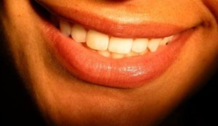 Úsměv s bílými zuby