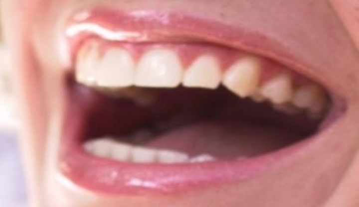 Úsměv s bílými zuby 